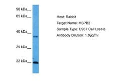 HspB2 Rabbit anti-Human, Polyclonal, Novus Biologicals 0.1 mL | Buy Online | Novus Biologicals | Fisher Scientific